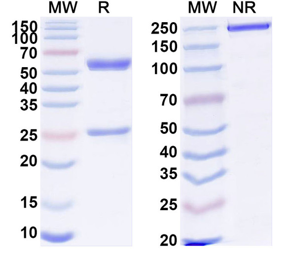 Anti-Human MB Monoclonal Antibody (1A600) - SDS-PAGE