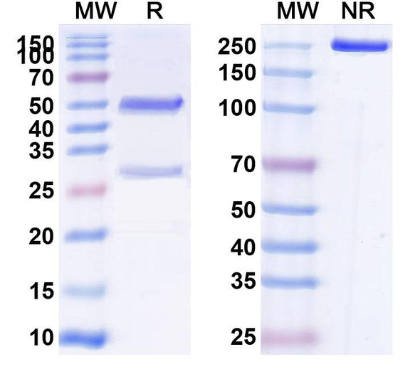 Anti-Human F8 Monoclonal Antibody (1A603) - SDS-PAGE