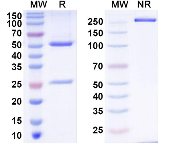 Anti-Human F8 Monoclonal Antibody (1A604) - SDS-PAGE