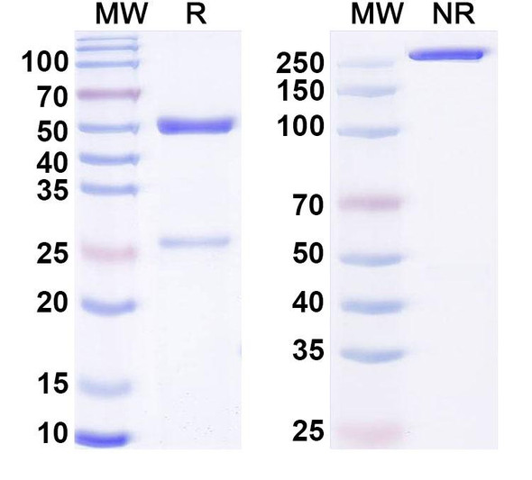 Anti-Human ANO1 Monoclonal Antibody (1A606) - SDS-PAGE