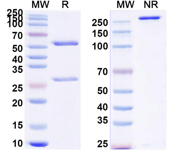 Anti-Human CD105/ENG Monoclonal Antibody (1A611) - SDS-PAGE