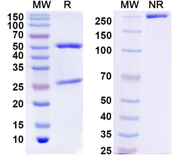 Anti-Human CD13/ANPEP Monoclonal Antibody (1A625) - SDS-PAGE