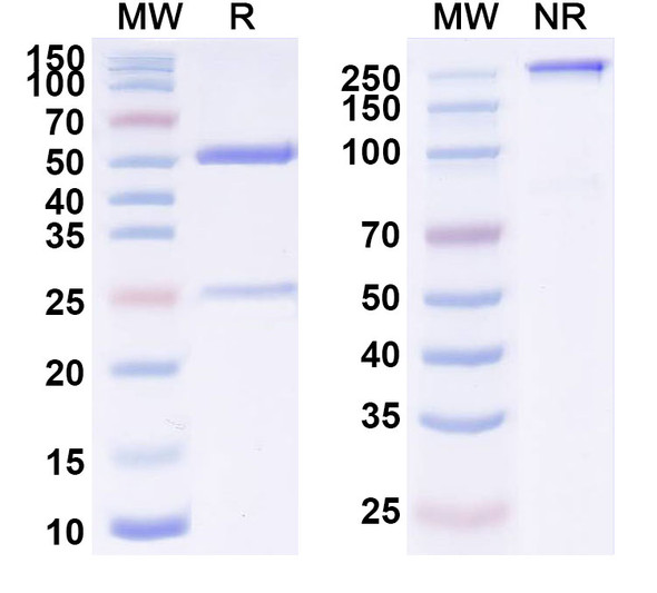 Anti-Human CD35/CR1 Monoclonal Antibody (1A629) - SDS-PAGE