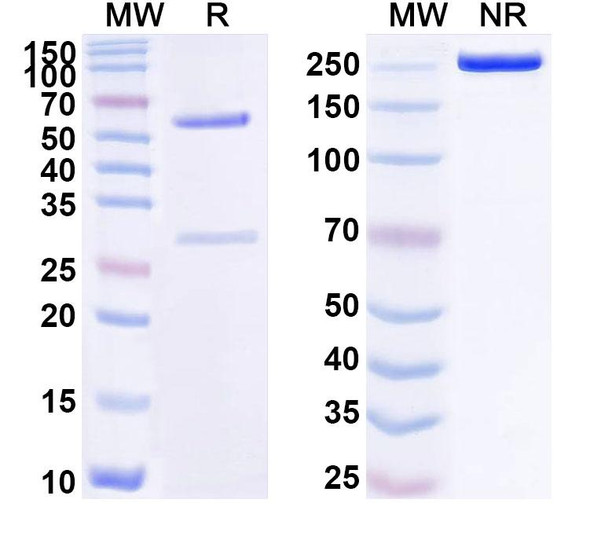 Anti-Human CA9 Monoclonal Antibody (1A631) - SDS-PAGE