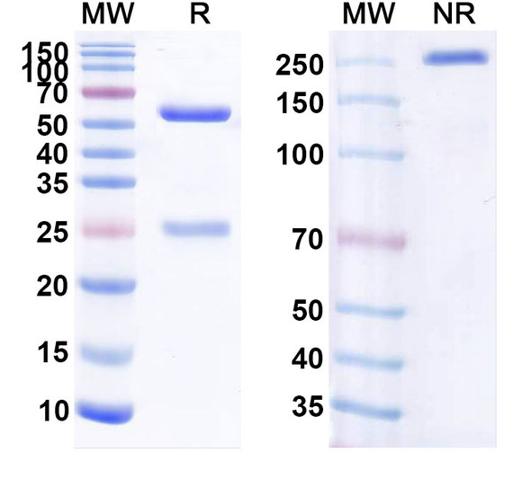Anti-Human CALB1 Monoclonal Antibody (1A643) - SDS-PAGE