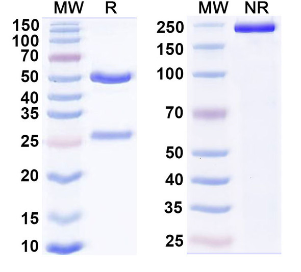Anti-Human SH2D1A Monoclonal Antibody (1A650) - SDS-PAGE