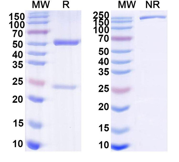 Anti-Human CXCL16/SR-PSOX Monoclonal Antibody (1A654) - SDS-PAGE