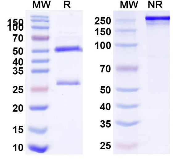 Anti-Human GP2 Monoclonal Antibody (1A657) - SDS-PAGE