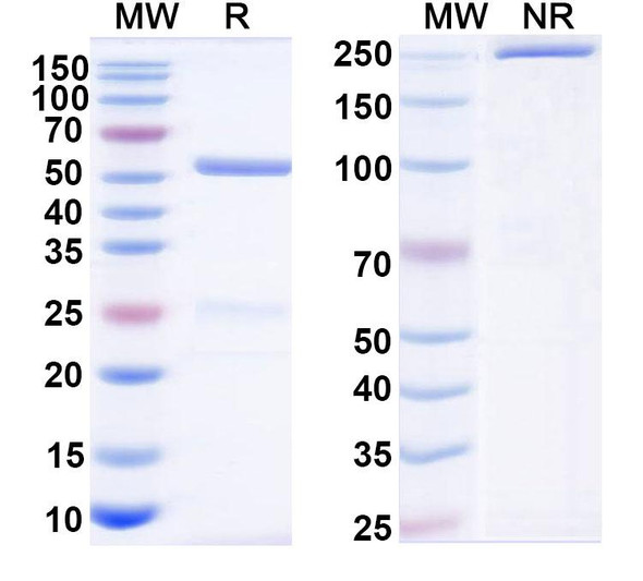 Anti-Human Calretinin/CALB2 Monoclonal Antibody (1A660) - SDS-PAGE