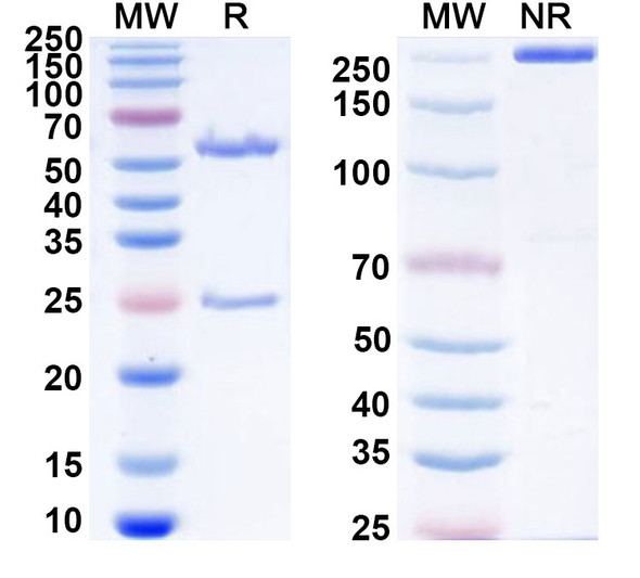Anti-Human CD11c/ITGAX Monoclonal Antibody (1A663) - SDS-PAGE