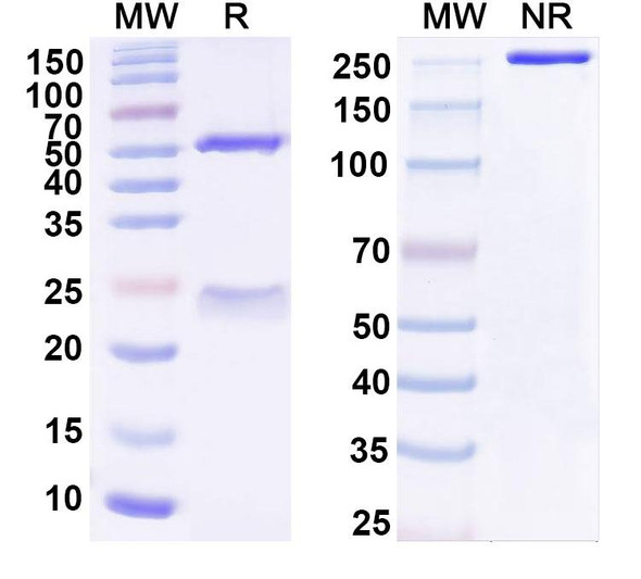 Anti-Human CD2AP Monoclonal Antibody (1A674) - SDS-PAGE
