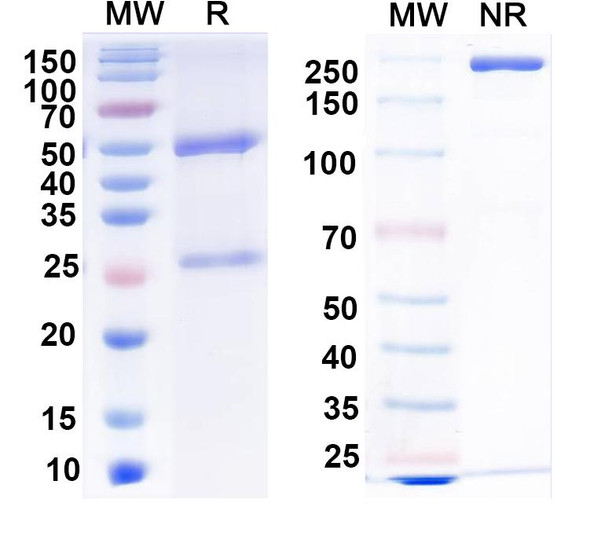 Anti-Human BCL6 Monoclonal Antibody (1A700) - SDS-PAGE