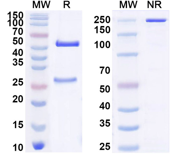Anti-Human NR5A1 Monoclonal Antibody (1A708) - SDS-PAGE