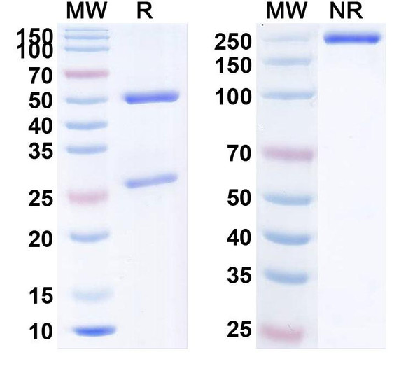 Anti-Human SLC22A2/OCT2 Monoclonal Antibody (1A710) - SDS-PAGE