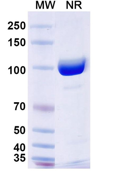 Anti-Human SFTPA Recombinant Monoclonal Antibody (SAA2226) - SDS-PAGE