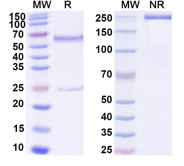 Anti-RNA Recombinant Monoclonal Antibody (D44) - SDS-PAGE