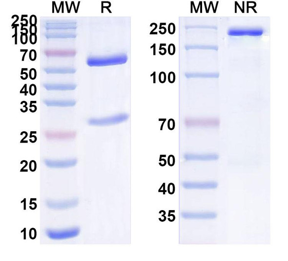 Anti-Human NPPB Recombinant Monoclonal Antibody (SAA0281) - SDS-PAGE