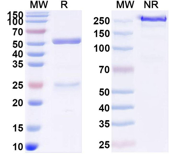 Anti-SARS-CoV-2 RBD Recombinant Monoclonal Antibody (CR3022) - SDS-PAGE