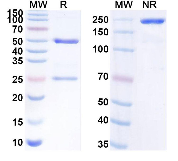 Anti-SARS-CoV-2 RBD Recombinant Monoclonal Antibody (1E4#) - SDS-PAGE
