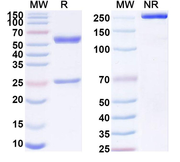 Anti-SARS-CoV-2 S2 Protein Recombinant Monoclonal Antibody (2D7) - SDS-PAGE
