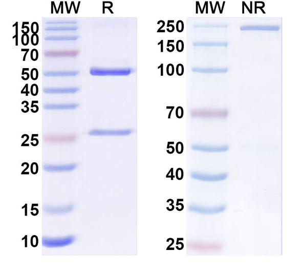 Anti-SARS-CoV-2 S2 Protein Recombinant Monoclonal Antibody (1B5) - SDS-PAGE