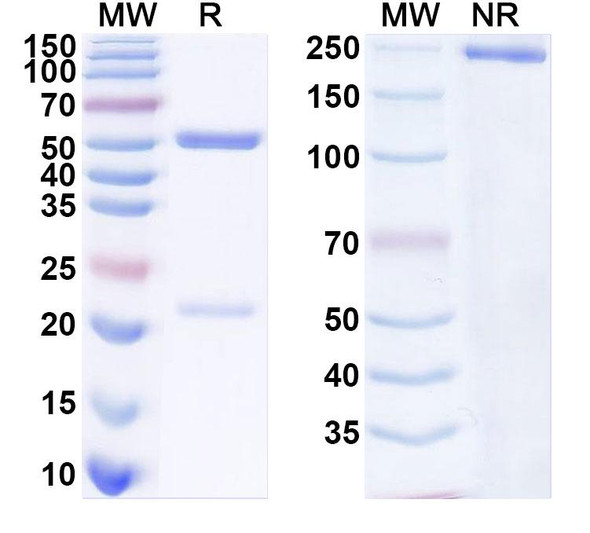 Anti-SARS-CoV-2 S Protein Recombinant Monoclonal Antibody (1H2) - SDS-PAGE