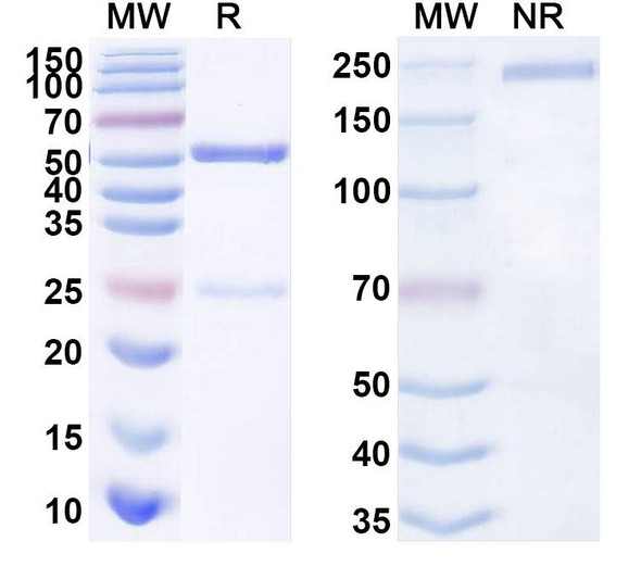 Anti-SARS-CoV-2 S Protein Recombinant Monoclonal Antibody (1H7) - SDS-PAGE