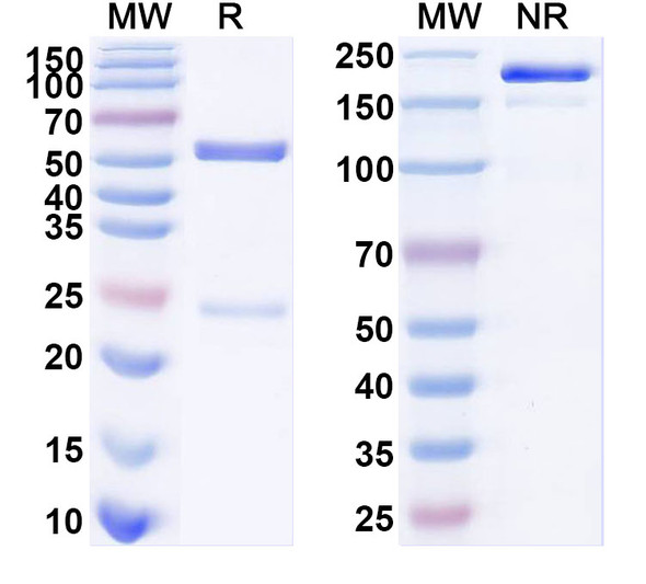 Anti-SARS-CoV-2 S Protein Recombinant Monoclonal Antibody (2F1) - SDS-PAGE