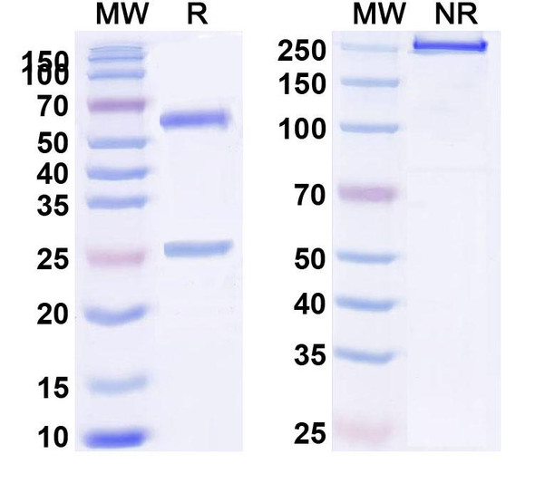 Anti-HLA-A2-peptide (ILAKFLHWL) Complex Recombinant Monoclonal Antibody (4G9) - SDS-PAGE