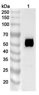 Anti-Human TSHR Recombinant Monoclonal Antibody (SAA0401) - WB