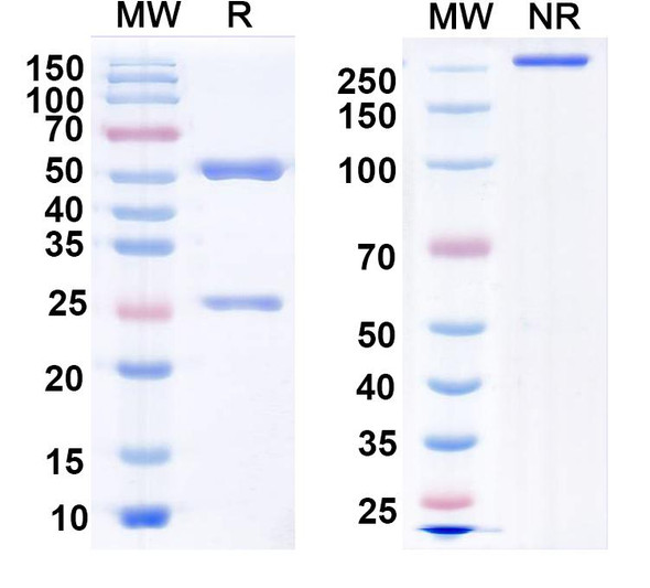 Anti-LASV GPC Recombinant Monoclonal Antibody (10.4B) - SDS-PAGE