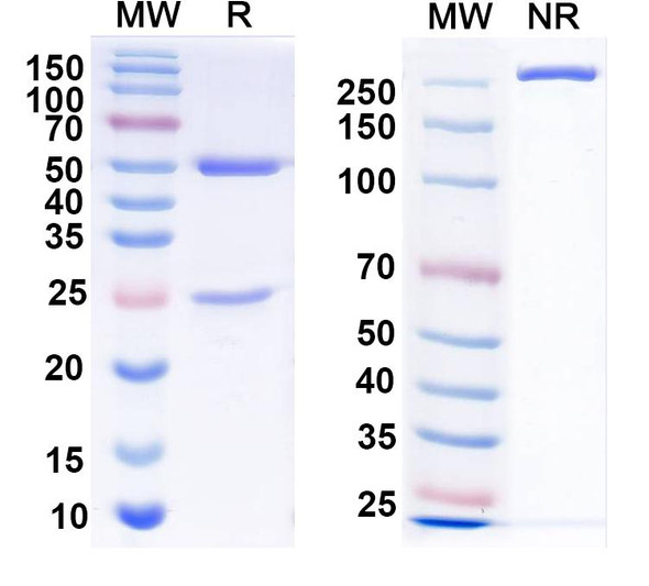 Anti-HeV/NiV Glycoprotein G Recombinant Monoclonal Antibody (HENV-32) - SDS-PAGE