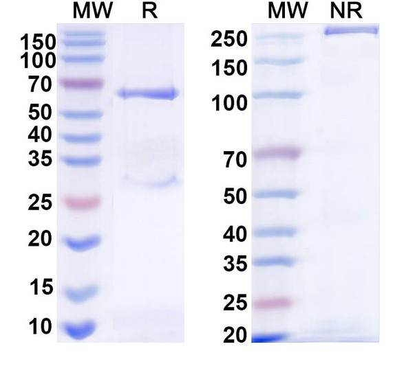 Anti-HRSV-A/BRSV F/Fusion glycoprotein F0 Recombinant Monoclonal Antibody (B4-1) - SDS-PAGE