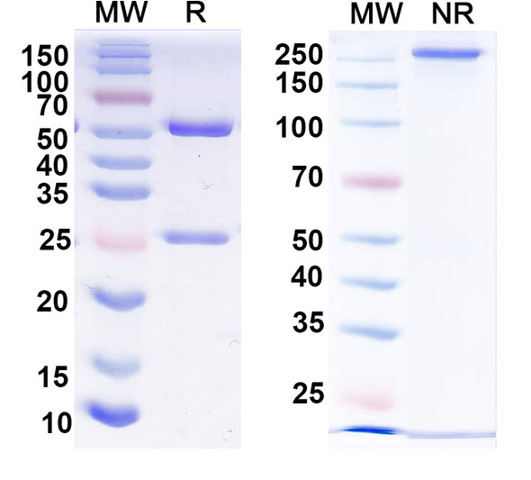 Anti-HRSV-A/B G/Major surface glycoprotein G Recombinant Monoclonal Antibody (131-2G) - SDS-PAGE