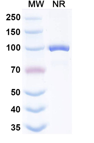 Anti-HPV16 E7/Protein E7 Recombinant Monoclonal Antibody (Nb4) - SDS-PAGE