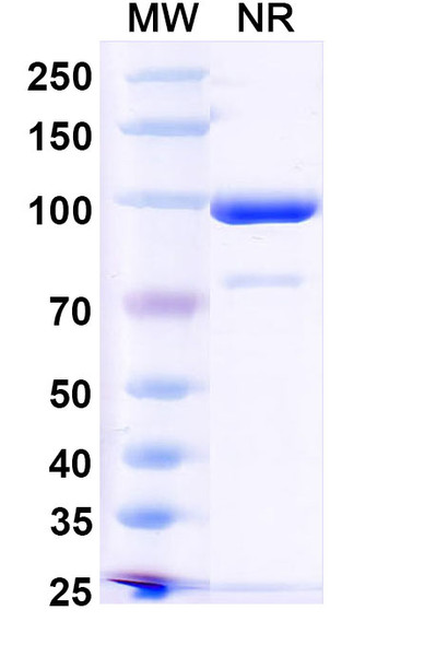Anti-HPV16 E7/Protein E7 Recombinant Monoclonal Antibody (Nb27) - SDS-PAGE