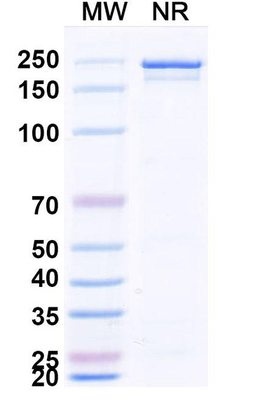 Anti-Rabies virus G/Glycoprotein Recombinant Monoclonal Antibody (17C7) - SDS-PAGE