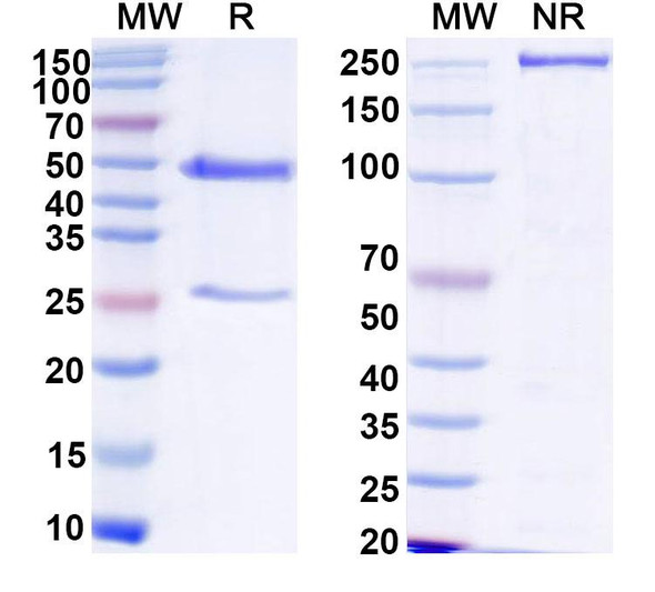 Anti-HCV gp32/gp35/Envelope glycoprotein E1 Recombinant Monoclonal Antibody (IGH526) - SDS-PAGE