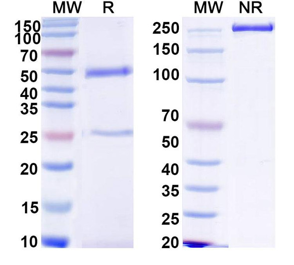 Anti-HCV NS1/gp68/gp70/Envelope glycoprotein E2 Recombinant Monoclonal Antibody (CM3.B6) - SDS-PAGE