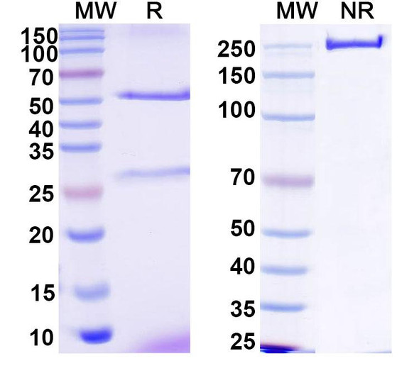 Anti-HCV NS1/gp68/gp70/Envelope glycoprotein E2 Recombinant Monoclonal Antibody (1:5#) - SDS-PAGE
