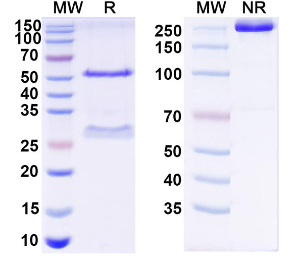 Anti-HCV NS1/gp68/gp70/Envelope glycoprotein E2 Recombinant Monoclonal Antibody (2A12) - SDS-PAGE