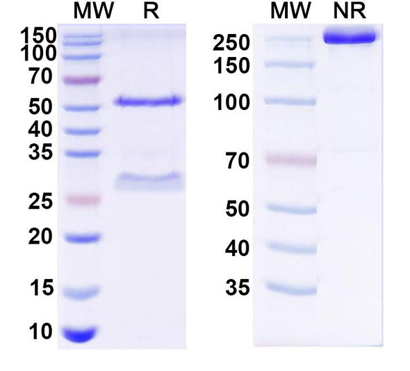Anti-HCV NS1/gp68/gp70/Envelope glycoprotein E2 Recombinant Monoclonal Antibody (2A12) - SDS-PAGE