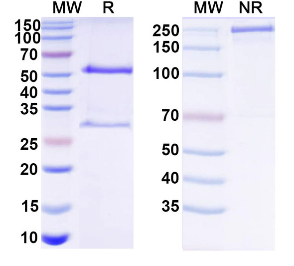 Anti-HCV Genome polyprotein Recombinant Monoclonal Antibody (D32.10) - SDS-PAGE