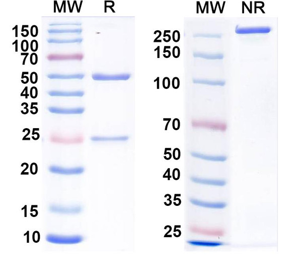 Anti-CHIKV Spike glycoprotein E2 Recombinant Monoclonal Antibody (5F10) - SDS-PAGE