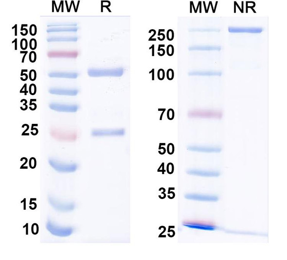 Anti-CHIKV p130/Structural polyprotein Recombinant Monoclonal Antibody (DC2.112) - SDS-PAGE