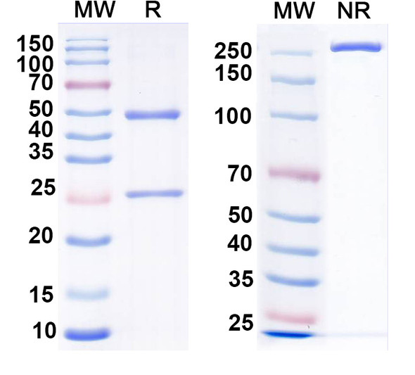 Anti-VSV G/Glycoprotein G Recombinant Monoclonal Antibody (1A10) - SDS-PAGE