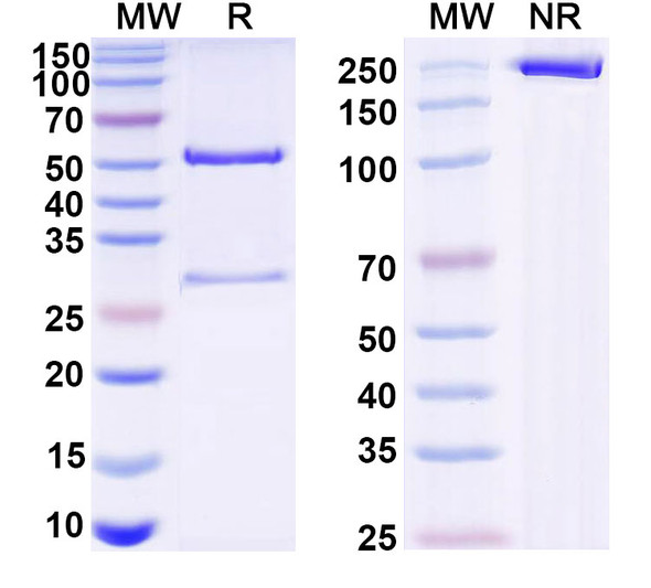 Anti-VSV G/Glycoprotein G Recombinant Monoclonal Antibody (0B1) - SDS-PAGE