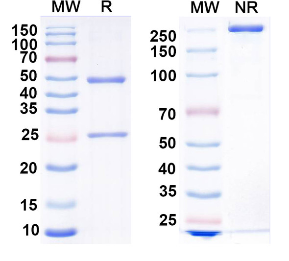 Anti-RABV G/Glycoprotein Recombinant Monoclonal Antibody (523-11#) - SDS-PAGE