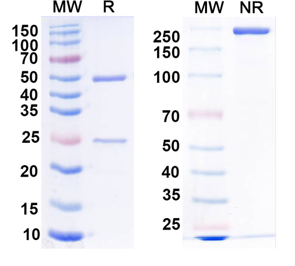 Anti-RABV G/Glycoprotein Recombinant Monoclonal Antibody (RVC20) - SDS-PAGE