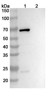Anti-Corynephage omega DT/Diphtheria toxin Recombinant Monoclonal Antibody (DTD8) - WB